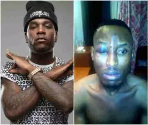 Police Declared Singer Burna Boy Wanted Over Robbery Attack On Mr 2kay
